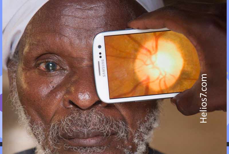 This Mobile App cures Blindness