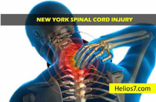 Find Spinal Cord Injury Lawyer
