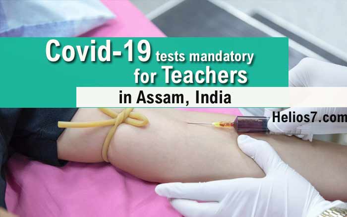 covid 19 test assam